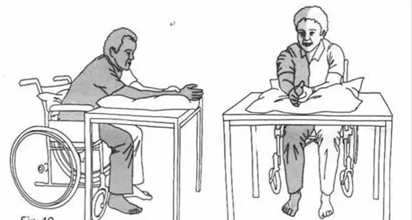 早期康復(fù)—良肢位的擺放